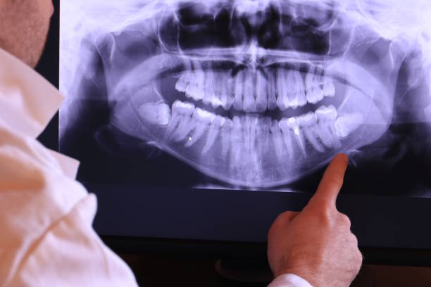 Best Emergency Root Canal Treatment in Maysville, GA