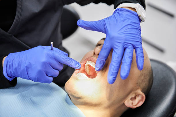 Best Emergency Dentist for Knocked-Out Tooth in Maysville, GA